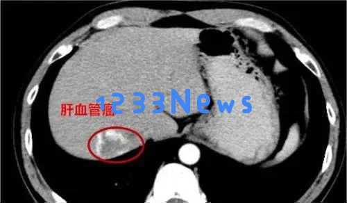 “网友探讨让我重获生机…”女生用手电筒照亮手部，网友们察觉异常引发关注