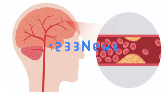 打破高血压的神秘面纱:大脑缺氧或为病因荷蓬茶源素提供新的降压方案