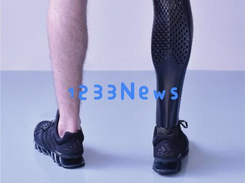 3D打印假肢