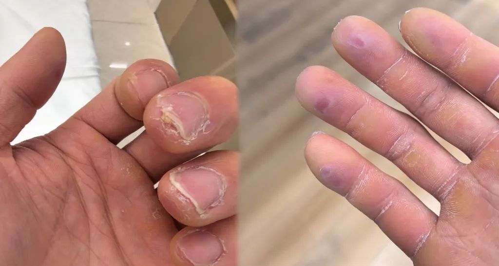 为国出征之际，他的指纹识别遇阻！出国后却创造了我军该项目的新高纪录