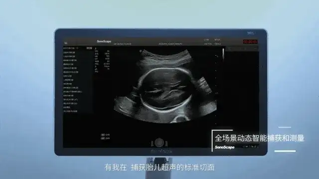 国内首个，AI产前超声获批