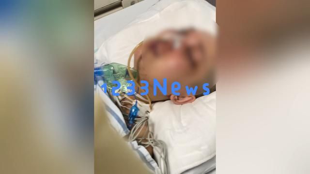19岁男子入室伤人后悠闲点外卖，年轻母亲护女遭袭致大脑萎缩如老年人，嫌疑人家属不愿现身