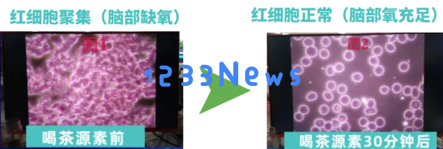 打破高血压的神秘面纱：大脑缺氧或为病因荷蓬茶源素提供新的降压方案