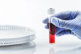 糖化血红蛋白揭示的四个关键健康信号
