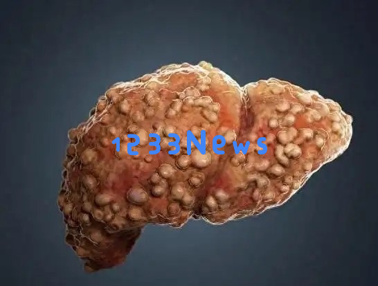 早晨如果出现这三种异常信号，可能是肝脏正在发出求救信号，务必引起重视！