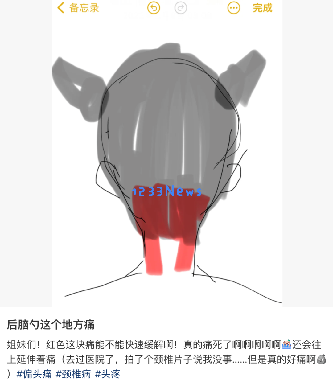 后脑勺下方的疼痛，并非偏头痛引起的症状解析