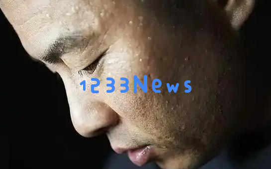 高温天气危险不断！医生重申这几项事项千万不能忽视以防热射病