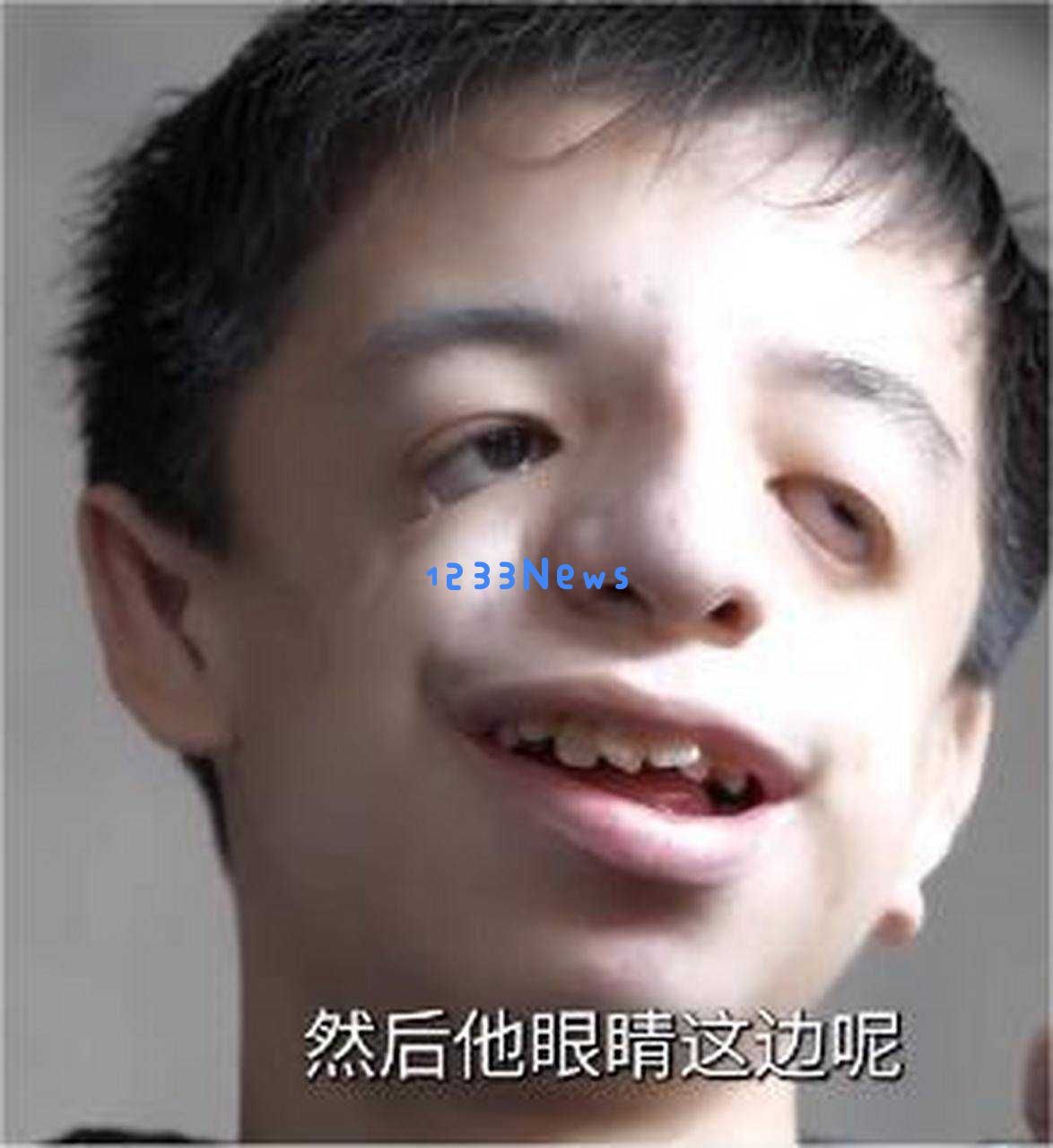 四年前婚礼被热议！新郎因罕见病遭遇网络暴力，“河童”背后的真相让人心痛