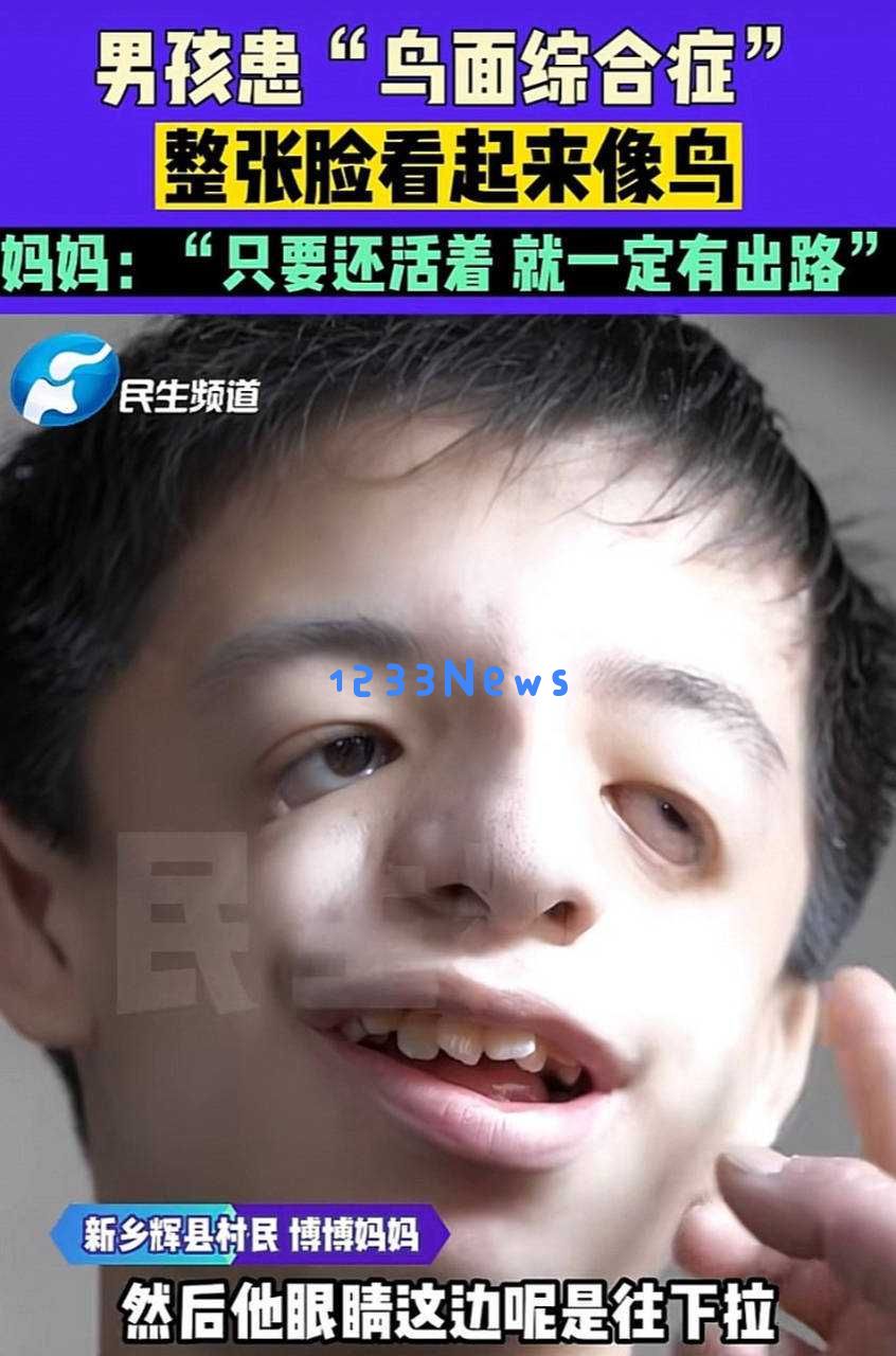 四年前感人婚礼重回热议！新郎因罕见疾病遭受攻击，真相曝光引发全网反思